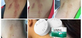 As 15 Maneiras de Usar a Aspirina que Você Não Sabia