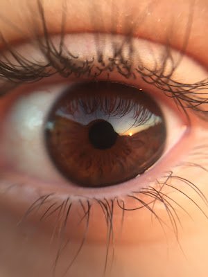 Seus olhos merecem um cuidado especial, e o soro fisiológico pode proporcionar isso! Além de limpar, ele também pode ser usado para umedecer e refrescar os olhos, principalmente quando estamos expostos a ambientes secos, como escritórios com ar-condicionado. Seus olhos vão agradecer!