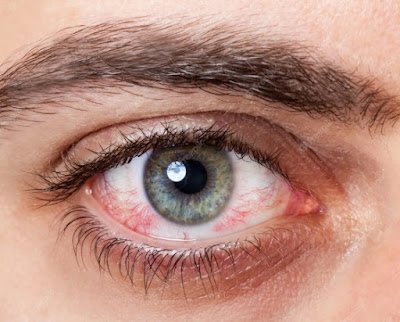 Seus olhos são as janelinhas da alma, então vamos deixá-los brilhando! O soro fisiológico é um verdadeiro elixir para revigorar seus olhos cansados. Seja após uma noite mal dormida ou muitas horas em frente ao computador, algumas gotinhas vão dar um up no seu olhar. Piscadela de frescor garantida!
